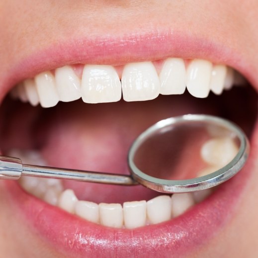 Dentist examining patient's smile during tooth-colored filling appointment