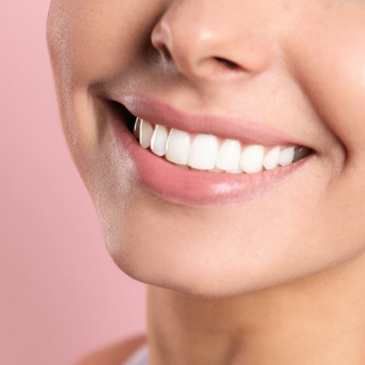 Closeup of beautiful smile after full mouth reconstruction