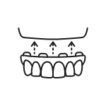Animated all on four dental implant denture placement